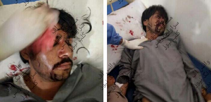 مستونگ ، دوقبائل میں تصادم،لاٹھیوں کے وار ،9  افراد زخمی