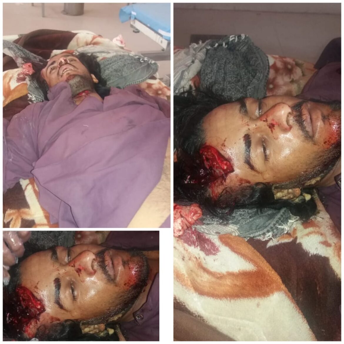نوشکی ،  ٹریفک حادثہ ایک شخص جاں بحق  ، ریکٹر کی ٹائر کو ہوا بھرتے ھوئے نوعمر لڑکا شدید زخمی