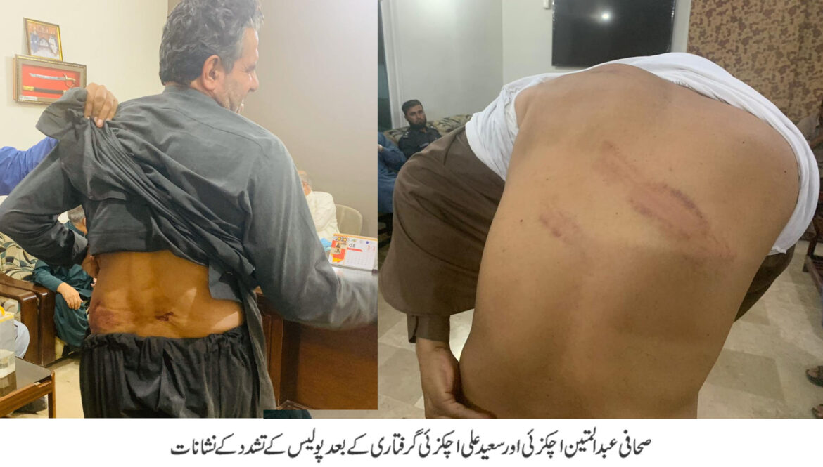 چمن پولیس کا دو صحافیوں پر تشدد ‘ حکومت ذمہ داریوں کیخلاف کارروائی کرے ‘ بی یو جے